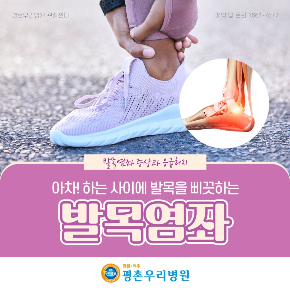 아차!하는 사이에 발목을 삐끗하는 발목염좌 증상과 응급처치